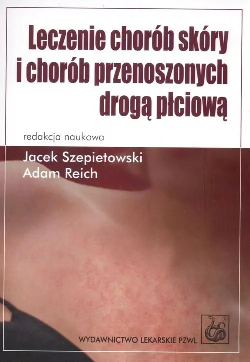Leczenie chorób skóry i chorób przenoszonych drogą płciową - tantis.pl