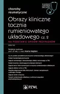 Obrazy kliniczne tocznia rumieniowatego układ cz.2 - tantis.pl