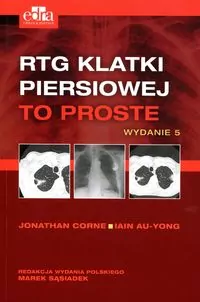 RTG klatki piersiowej. To proste - tantis.pl