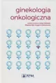 Ginekologia onkologiczna. - tantis.pl