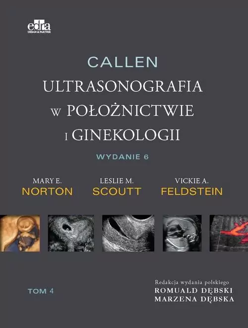 Callen Ultrasonografia w położnictwie i ginekologii  Tom 4 - tantis.pl