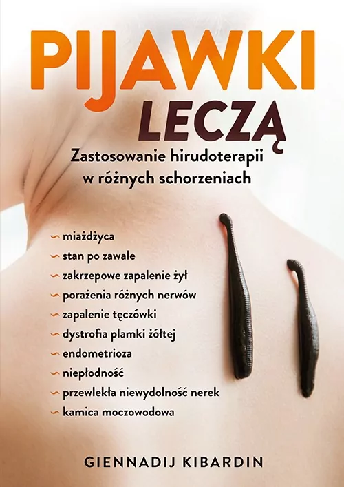 Pijawki leczą. Zastosowanie hirudoterapii w różnych schorzeniach - tantis.pl