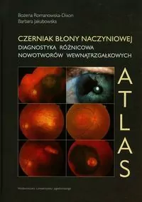 Czerniak błony naczyniowej Diagnostyka różnicowa nowotworów wewnątrzgałkowych - tantis.pl