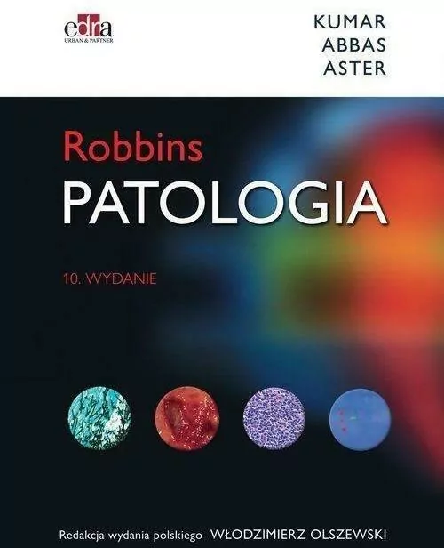 Patologia Robbins - tantis.pl