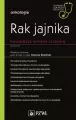 Rak jajnika. Najnowsze metody leczenia. W gabineci - tantis.pl