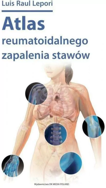 Atlas reumatoidalnego zapalenia stawów - tantis.pl