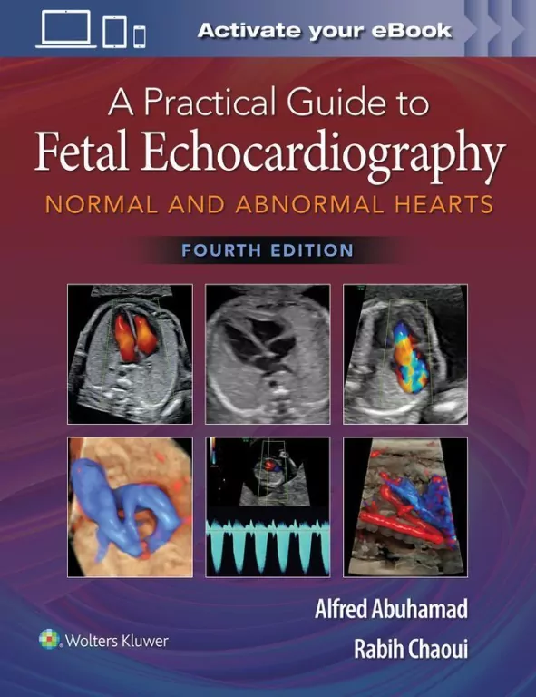 A Practical Guide to Fetal Echocardiography - tantis.pl