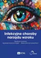 Infekcyjne choroby narządu wzroku - tantis.pl