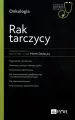 Rak tarczycy - tantis.pl