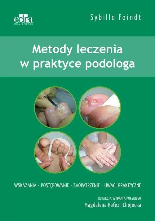 Metody leczenia w podologii - tantis.pl