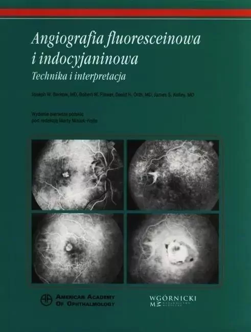 Angiografia fluoresceinowa i indocyjaninowa - tantis.pl