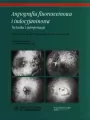 Angiografia fluoresceinowa i indocyjaninowa - tantis.pl
