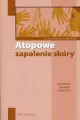 Atopowe zapalenie skóry. Poradnik lekarza praktyka - tantis.pl