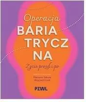Operacja bariatryczna. Życie przed i po - tantis.pl