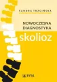 Nowoczesna diagnostyka skolioz - tantis.pl