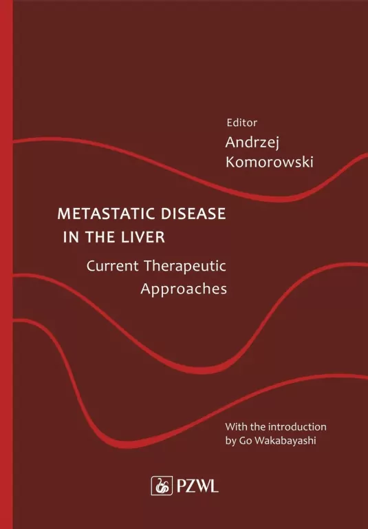 Metastatic Disease in the Liver - Current Therapeutic Approaches - tantis.pl
