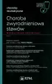 Choroba zwyrodnieniowa stawów - tantis.pl