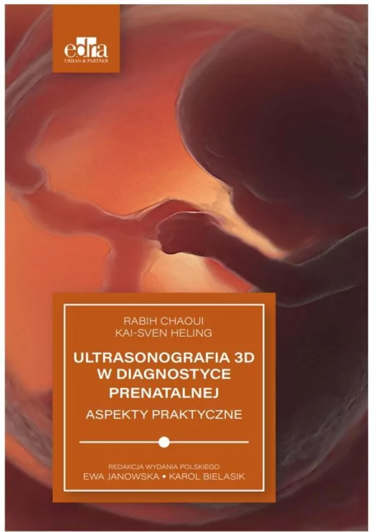 Ultrasonografia 3D w diagnostyce prenatalnej - tantis.pl