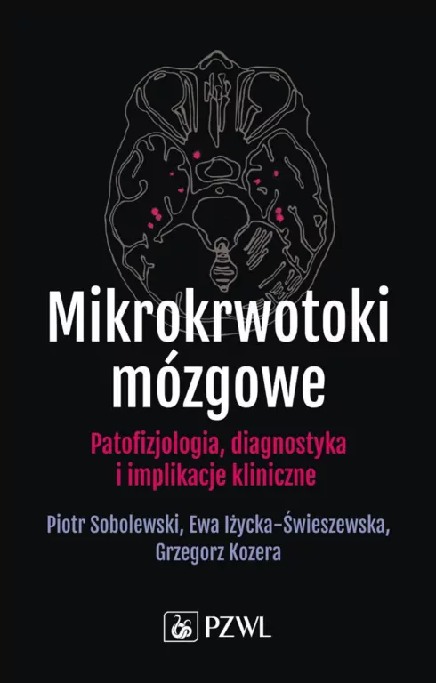 Mikrokrwotoki mózgowe - tantis.pl