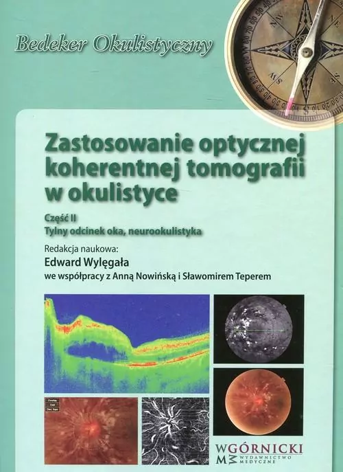 Zastosowanie optycznej koherentnej tomografii w okulistyce Część 2 - tantis.pl