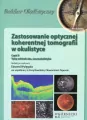 Zastosowanie optycznej koherentnej tomografii w okulistyce Część 2 - tantis.pl