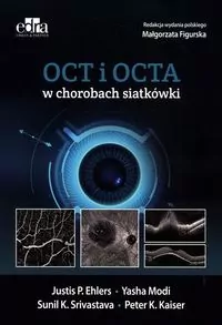 OCT i OCTA w chorobach siatkówki - tantis.pl