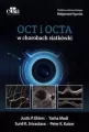 OCT i OCTA w chorobach siatkówki - tantis.pl