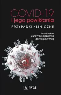 COVID-19 i jego powikłania. Przypadki kliniczne - tantis.pl