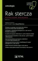 Rak stercza. Współczesne spojrzenie - tantis.pl
