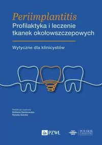 Periimplantitis. Profilaktyka i leczenie tkanek... - tantis.pl