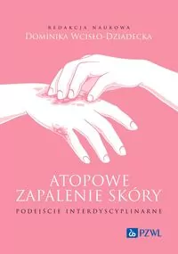 Atopowe zapalenie skóry. Podejście interdyscyplina - tantis.pl
