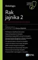 Rak jajnika 2. Najnowsze metody leczenia - tantis.pl