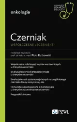 Czerniak. Współczesne leczenie (5)