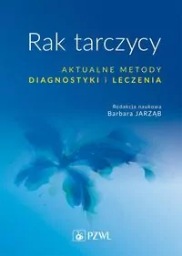 Rak tarczycy. Aktualne metody diagnostyki i leczen - tantis.pl