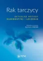 Rak tarczycy. Aktualne metody diagnostyki i leczen - tantis.pl