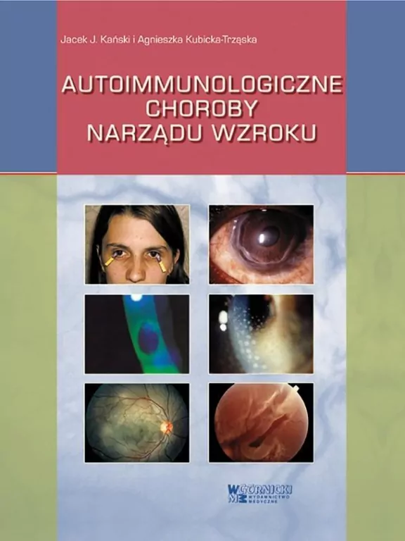 Autoimmunologiczne choroby narządu wzroku - tantis.pl