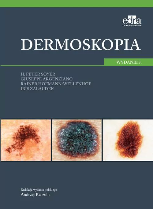 Dermoskopia - tantis.pl
