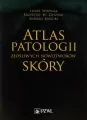 Atlas patologii złośliwych nowotworów skóry - tantis.pl
