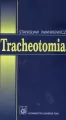 Tracheotomia - tantis.pl