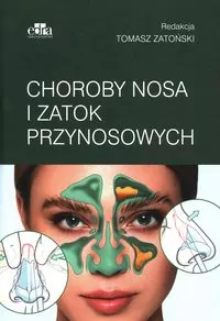 Choroby nosa i zatok przynosowych - tantis.pl