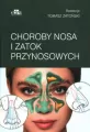 Choroby nosa i zatok przynosowych - tantis.pl
