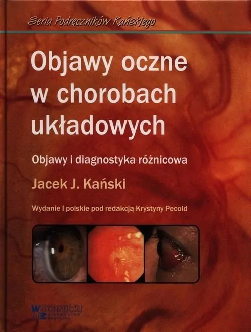Objawy oczne w chorobach układowych - tantis.pl