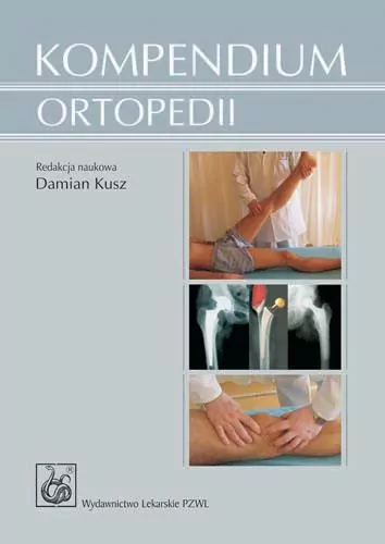 Kompendium ortopedii PZWL - tantis.pl