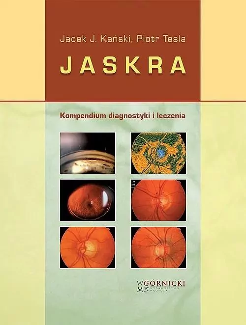 Jaskra. Kompendium diagnostyki i leczenia - tantis.pl