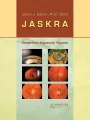 Jaskra. Kompendium diagnostyki i leczenia - tantis.pl