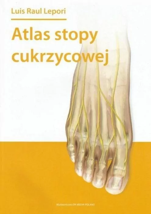 Atlas stopy cukrzycowej - tantis.pl